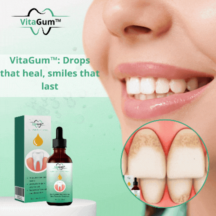 „VitaGum™ Gum Repair Drops | Tilgad, mis tervendavad, naeratused, mis kestavad!